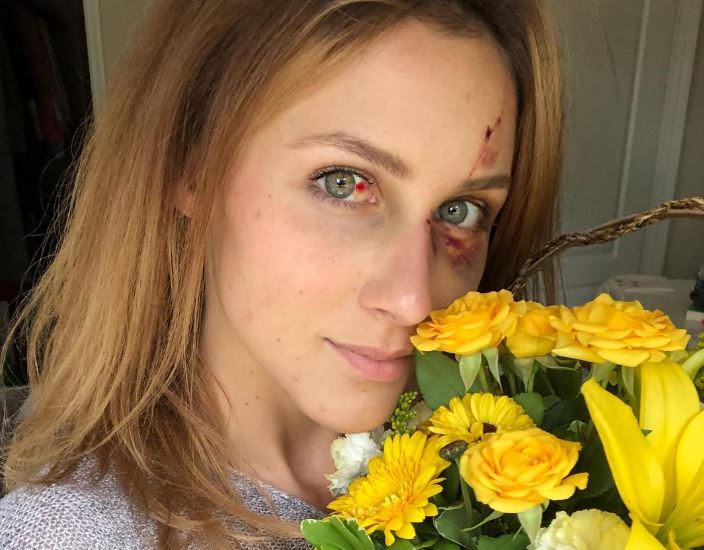 Explore Instagram Model Melissa Gentz Wiki Facts: Why Did Her Boyfriend Assault Her? Melissa Gentz wiki, age, bio, boyfriend, net worth
