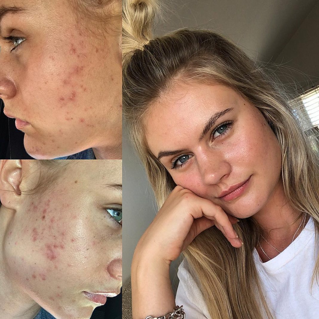jordan simek wiki, bio, age, height, boyfriend, net worth, before & after