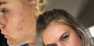 jordan simek wiki, bio, age, height, boyfriend, net worth, before & after